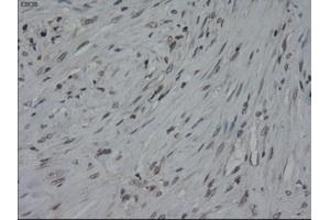 Immunohistochemical staining of paraffin-embedded colon using anti-IL-3 (ABIN2452543) mouse monoclonal antibody. (IL-3 antibody  (AA 20-152))