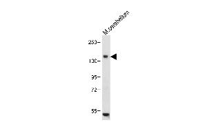 Anti-c-KIT Antibody (N-term) at 1:1000 dilution+ Mouse cerebellum tissue lysate Lysates/proteins at 20 μg per lane. (KIT antibody  (N-Term))