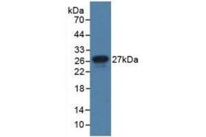 Western blot analysis of recombinant Human JAM1. (F11R antibody  (AA 64-249))