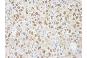Immunohistochemistry (IHC) image for anti-Protein Phosphatase 4, Catalytic Subunit (PPP4C) (AA 1-50) antibody (ABIN7448739)