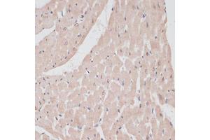 Immunohistochemistry of paraffin-embedded rat heart using PRPF31 antibody (ABIN6132996, ABIN6146262, ABIN6146264 and ABIN6221399) at dilution of 1:100 (40x lens). (PRPF31 antibody  (AA 1-200))