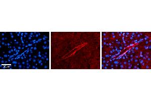 Immunohistochemistry (IHC) image for anti-Apolipoprotein B mRNA Editing Enzyme, Catalytic Polypeptide-Like 3G (APOBEC3G) (N-Term) antibody (ABIN2777994)