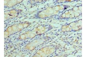 Immunohistochemistry of paraffin-embedded human colon tissue using ABIN7154290 at dilution of 1:100 (GOLM1 antibody  (AA 112-401))