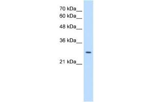 WB Suggested Anti-EBP Antibody Titration:  0. (EBP antibody  (N-Term))