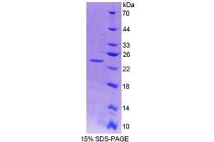 SDS-PAGE (SDS) image for Ninein (GSK3B Interacting Protein) (NIN) (AA 1-153) protein (His tag) (ABIN6239120) (Ninein Protein (AA 1-153) (His tag))