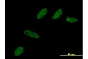 Immunofluorescence of monoclonal antibody to BCL2L12 on HeLa cell. (BCL2L12 antibody  (AA 174-273))