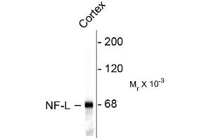 Western blots of rat cortex lysate showing specific immunolableing of the ~ 68k NF-L protein.