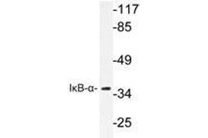 Western blot analyzes of IκB-α antibody in extracts from 293 cells. (NFKBIA antibody)