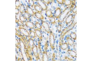 Immunohistochemistry of paraffin-embedded mouse kidney using  antibody (ABIN6129195, ABIN6137096, ABIN6137097 and ABIN6220538) at dilution of 1:100 (40x lens). (ARHGEF5 antibody  (AA 1248-1597))
