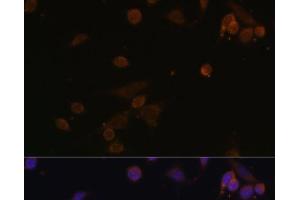 Immunofluorescence analysis of NIH/3T3 cells using NDUFA2 Polyclonal Antibody at dilution of 1:100. (NDUFA2 antibody)