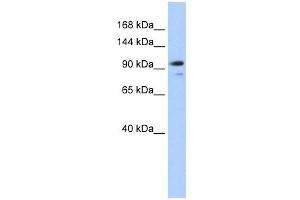 AMOTL1 antibody used at 1 ug/ml to detect target protein. (AMOTL1 antibody  (N-Term))