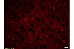 Formalin-fixed and paraffin embedded: rat brain tissue labeled with Anti-MBP Polyclonal Antibody (ABIN739400), Unconjugated at 1:200, followed by conjugation to the secondary antibody was Goat Anti-Rabbit IgG, PE conjugated at 1:200 for 40 minutes at 37°C (MBP antibody  (AA 69-85))