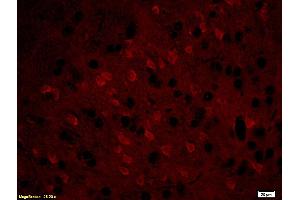 Formalin-fixed and paraffin embedded: rat brain tissue labeled with Anti-MBP Polyclonal Antibody (ABIN739400), Unconjugated at 1:200, followed by conjugation to the secondary antibody was Goat Anti-Rabbit IgG, PE conjugated at 1:200 for 40 minutes at 37°C (MBP antibody  (AA 69-85))