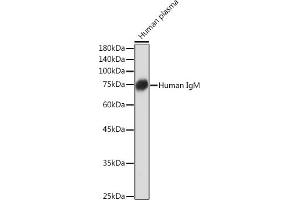 Western blot analysis of extracts of Human plasma, using Human IgM Rabbit mAb (ABIN7267845) at 1:1000 dilution. (IGHM antibody)