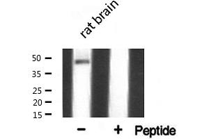 Western blot analysis of AP 2 expression in COLO205 cells