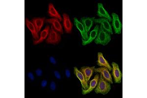 ABIN7094850 and ABIN7098901 staining Hela cells by IF/ICC.