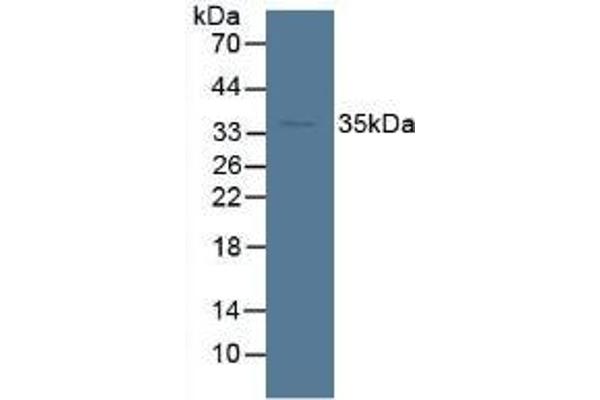 SORD antibody  (AA 98-355)