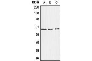 Western blot analysis of JNK3 expression in NIH3T3 (A), SKNSH (B), HeLa (C) whole cell lysates.