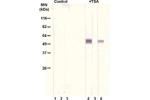 Treatment of A549 cells with the histone deacetylase inhibitor trichostatin A (TSA, 0. (alpha Tubulin antibody  (acLys40))