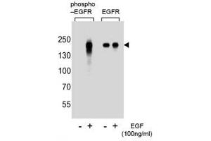 Western blot analysis of extracts from A431 cells, untreated or treated with EGF, using phospho-EGFR antibody (left) or nonphos Ab (right) (EGFR antibody  (pTyr1172))