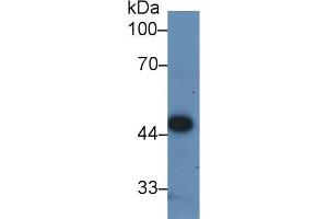 Detection of PDHA1 in Human ECV304 cell lysate using Polyclonal Antibody to Pyruvate dehydrogenase alpha 1 (PDHA1) (PDHA1 antibody  (AA 30-390))