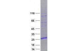 Validation with Western Blot (ZNHIT3 Protein (Myc-DYKDDDDK Tag))