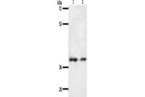 Western Blotting (WB) image for anti-Somatostatin Receptor 1 (SSTR1) antibody (ABIN2432308) (SSTR1 antibody)