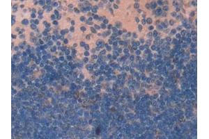 Detection of NUCB2 in Mouse Spleen Tissue using Polyclonal Antibody to Nucleobindin 2 (NUCB2) (NUCB2 antibody  (AA 25-420))
