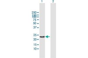 Western Blot analysis of SENP8 expression in transfected 293T cell line by SENP8 MaxPab polyclonal antibody. (SENP8 antibody  (AA 1-212))