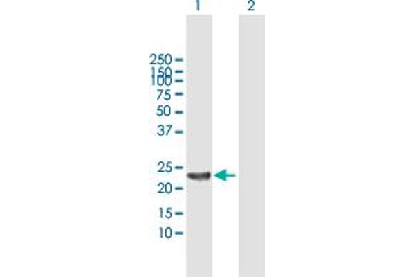 SENP8 anticorps  (AA 1-212)