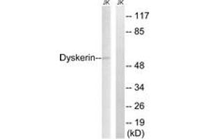 Western blot analysis of extracts from JurKat cells, using Dyskerin Antibody. (DKC1 antibody  (AA 171-220))