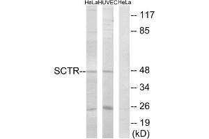 Western blot analysis of extracts from HeLa cells and HUVEC cells, using SCTR antibody. (SCTR antibody  (Internal Region))