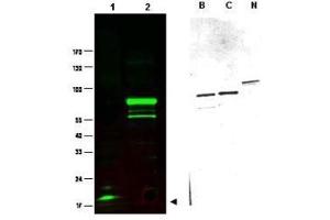 Western blot using  Protein A purified anti-SPANX-C antibody shows detection of a band at ~17 kDa corresponding to SPANX-C present in a nuclear extract from VWM105 cells (left panel, arrowhead). (SPANXC antibody)
