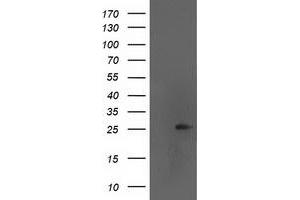 HEK293T cells were transfected with the pCMV6-ENTRY control (Left lane) or pCMV6-ENTRY AK4 (Right lane) cDNA for 48 hrs and lysed. (AK4 antibody)