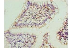Immunohistochemistry of paraffin-embedded human small intestine tissue using ABIN7152648 at dilution of 1:100 (FAR2 antibody  (AA 1-300))