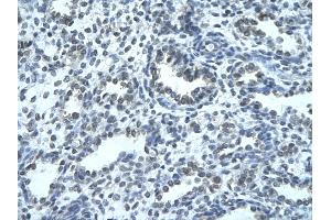 Rabbit Anti-IKZF4 Antibody Catalog Number: ARP33275  Paraffin Embedded Tissue: Human alveolar cell  Cellular Data: Epithelial cells of renal tubule Antibody Concentration:  4. (IKZF4 antibody  (N-Term))