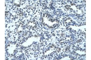 Rabbit Anti-IKZF4 Antibody Catalog Number: ARP33275  Paraffin Embedded Tissue: Human alveolar cell  Cellular Data: Epithelial cells of renal tubule Antibody Concentration:  4.