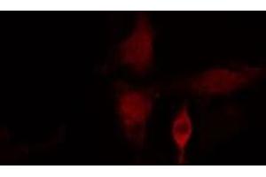 ABIN6275415 staining  HuvEc cells by IF/ICC. (SSH3 antibody  (Internal Region))