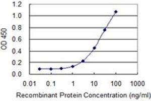 Detection limit for recombinant GST tagged ST13 is 0. (HSC70 Interacting Protein HIP antibody  (AA 1-58))