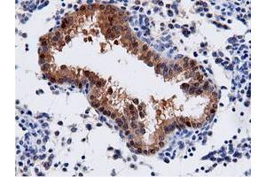 Immunohistochemistry (IHC) image for anti-Adenylate Kinase 5 (AK5) antibody (ABIN1496535) (Adenylate Kinase 5 antibody)