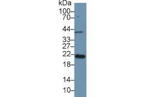 Detection of APOM in Mouse Placenta lysate using Polyclonal Antibody to Apolipoprotein M (APOM) (Apolipoprotein M antibody  (AA 20-190))