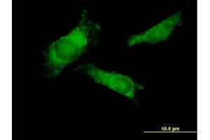Immunofluorescence of purified MaxPab antibody to RNF14 on HeLa cell. (RNF14 antibody  (AA 1-348))