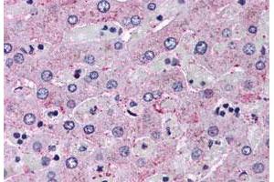 Immunohistochemistry (Formalin/PFA-fixed paraffin-embedded sections) of human liver tissue with GCGR polyclonal antibody . (Glucagon Receptor antibody  (Extracellular Domain))
