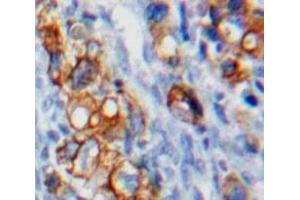 Used in DAB staining on fromalin fixed paraffin-embedded Ovary tissue (VTCN1 antibody  (AA 153-241))