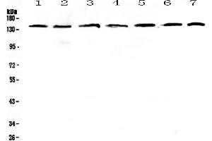 Western blot analysis of PERK using anti-PERK antibody . (PERK antibody  (AA 222-334))