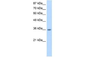 RP11-78J21. (HNRNPA1L2 antibody  (N-Term))