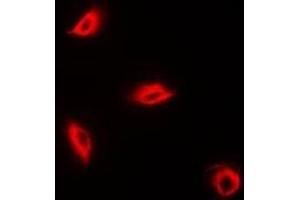 Immunofluorescent analysis of Perforin 1 staining in K562 cells. (Perforin 1 antibody)