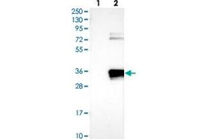 Western blot analysis of Lane 1: Negative control (vector only transfected HEK293T lysate), Lane 2: Over-expression Lysate (Co-expressed with a C-terminal myc-DDK tag (~3. (APIP antibody)