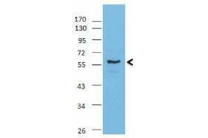 Western Blotting (WB) image for anti-IKAROS Family Zinc Finger 3 (Aiolos) (IKZF3) antibody (ABIN2666386) (IKZF3 antibody)