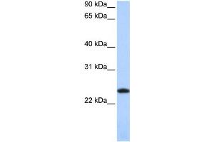 Western Blotting (WB) image for anti-Ferritin, Light Polypeptide (FTL) antibody (ABIN2459726) (FTL antibody)